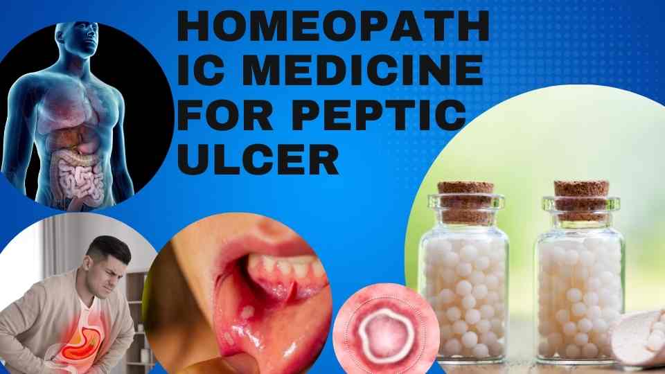 homeopathic medicine for peptic ulcer